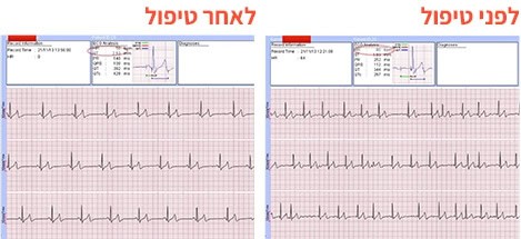 תוצאות בדיקה לפני ואחרי